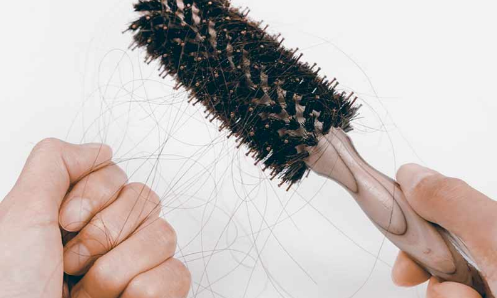 5 solutions contre la chute des cheveux