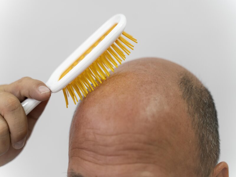 Clonage capillaire Estil possible de cloner des cheveux — free download