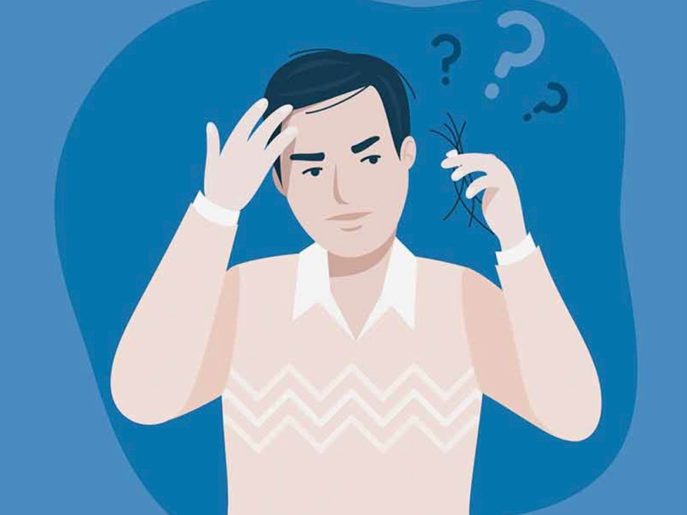 Perte de cheveux après greffe de cheveux 2