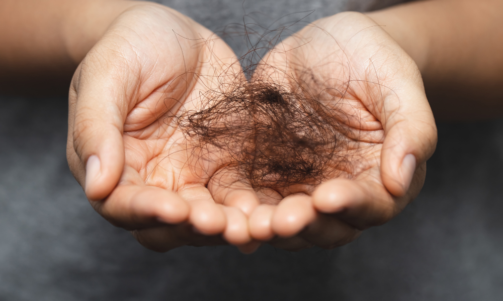 Perte de cheveux après greffe de cheveux : Est-ce normal?