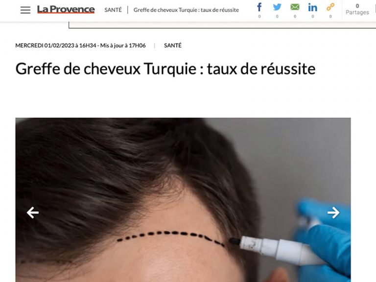 greffe de cheveux en Turquie La Provence HairBack Clinic