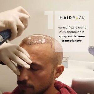 guide complet de lavage des cheveux après la greffe capillaire