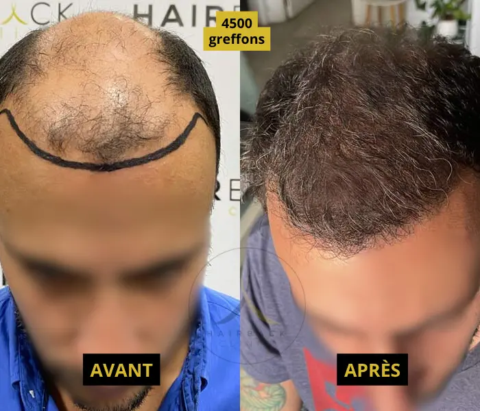 résultats 4500 exemple 2