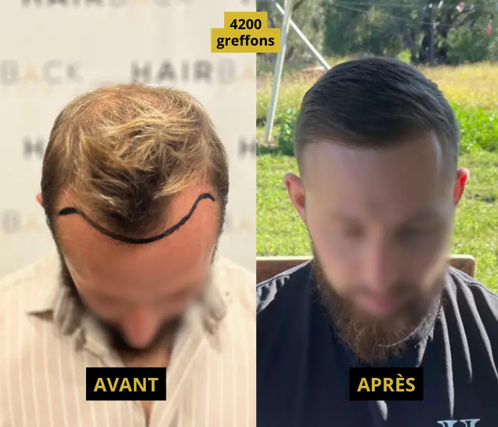 résultats 4200