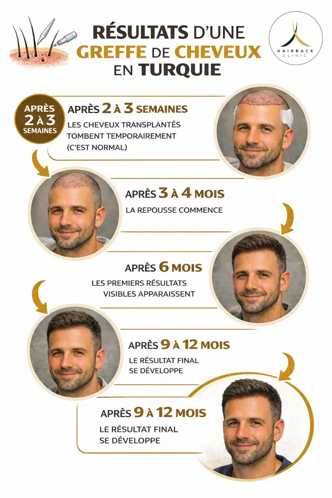 Résultats et taux de réussite d’une greffe de cheveux png