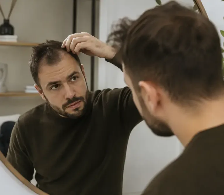 Featured Image - Les Stades De La Calvitie Masculine Expliqués